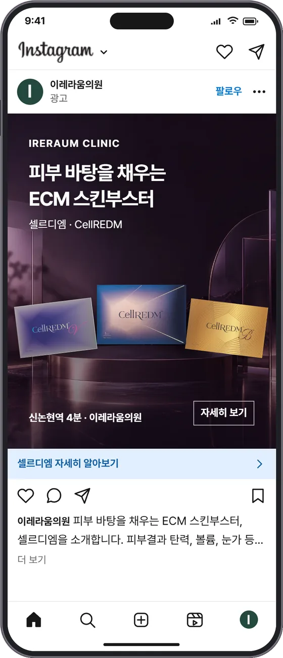 A · 제품 설명 인스타그램 광고 목업