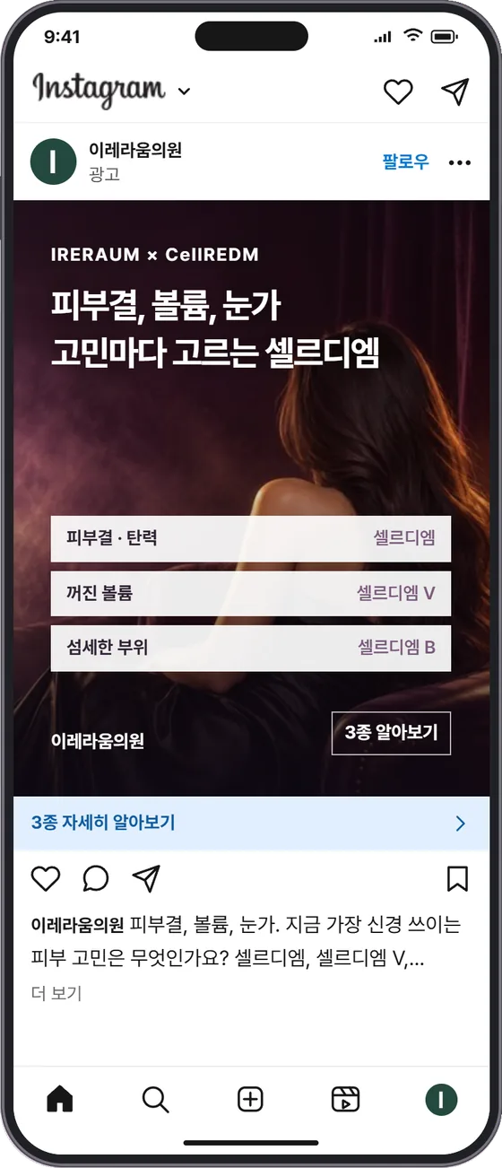 B · 고민별 선택 인스타그램 광고 목업