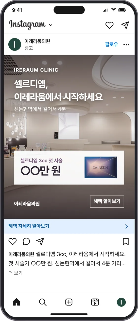 C · 이레라움 혜택 인스타그램 광고 목업